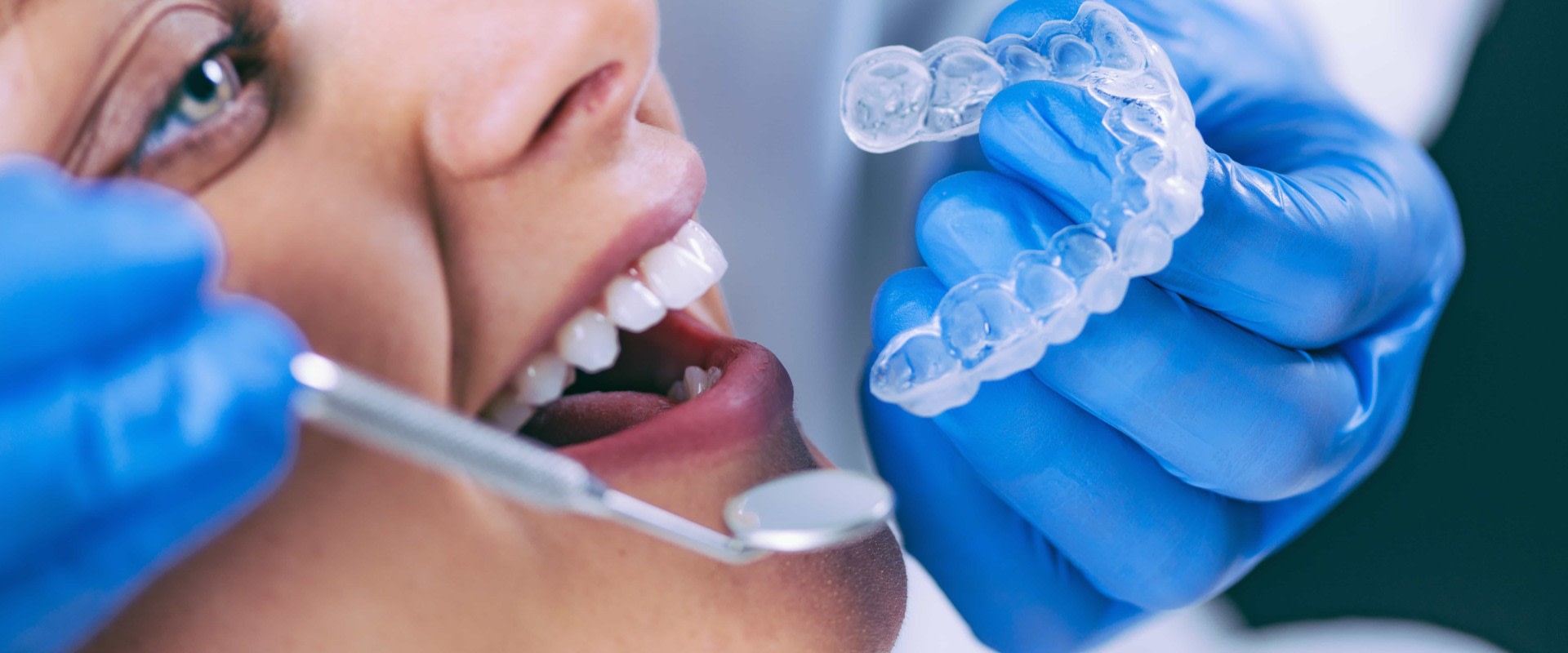 Preventive Health Care In Austin: Transform Your Smile With The Best Dentist For Quality Teeth Whitening Services