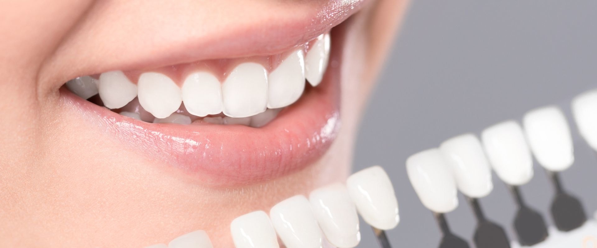 Why Teeth Whitening Is An Important Part Of Preventive Health Care In London