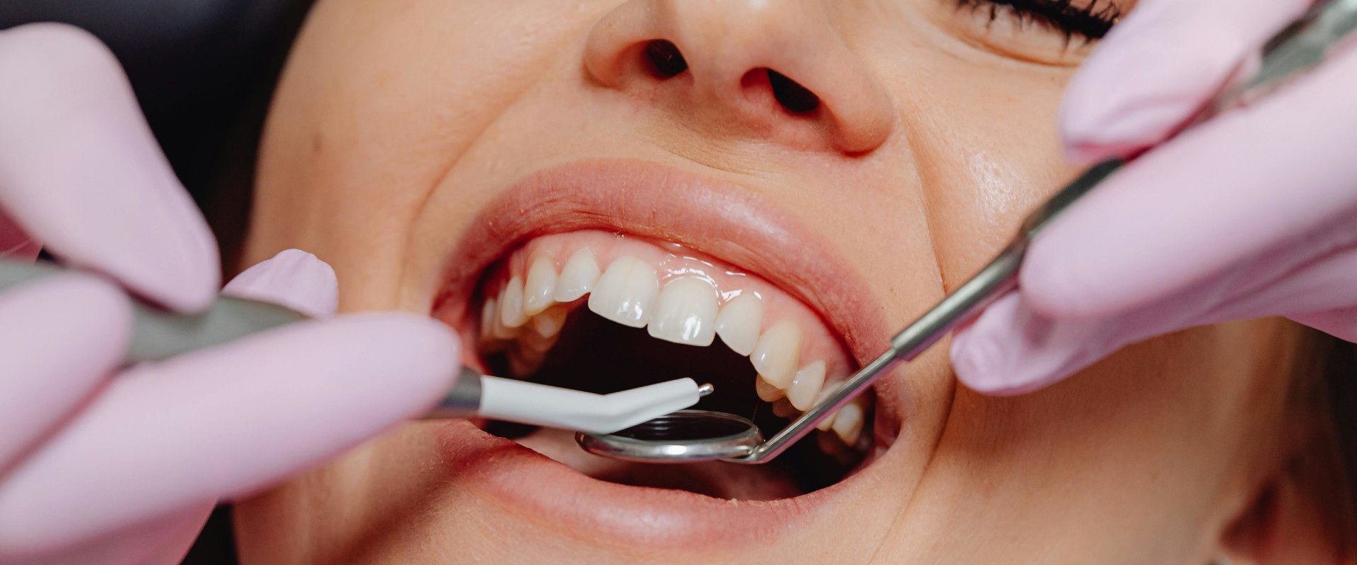 Unveiling The Impact Of Dental Services On Preventive Health Care In Dripping Springs