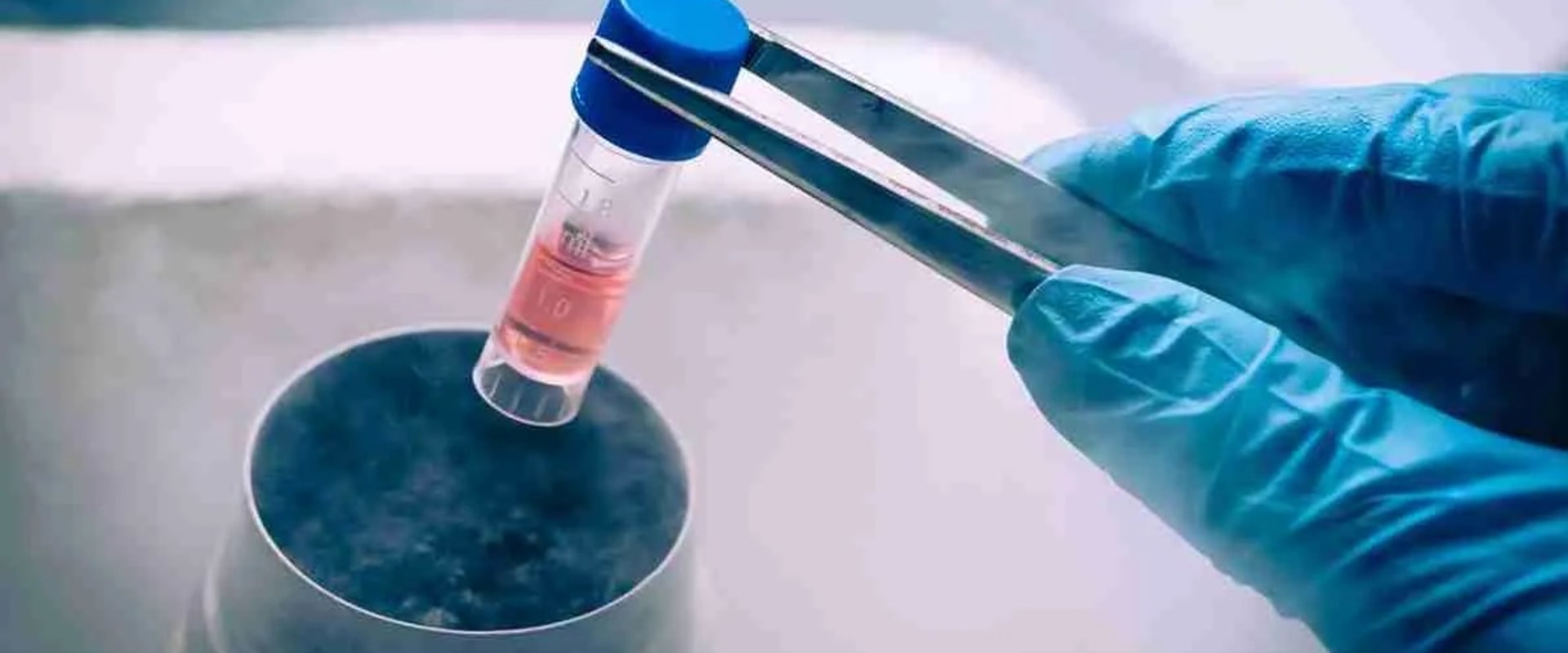 The Advantages Of IV Stem Cell Therapies In South Carolina For Your Preventive Healthcare