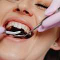Unveiling The Impact Of Dental Services On Preventive Health Care In Dripping Springs