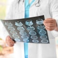 Preventive Health Care In The Virgin Islands: How A Neurologist Can Help