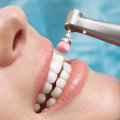 Smile Bright, Stay Healthy: Prioritizing Oral Care In Manassas Park For Preventive Health Care