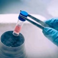 The Advantages Of IV Stem Cell Therapies In South Carolina For Your Preventive Healthcare