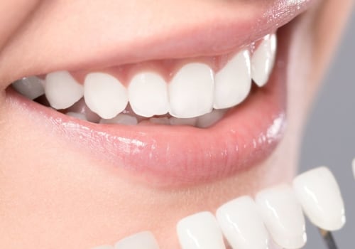 Why Teeth Whitening Is An Important Part Of Preventive Health Care In London