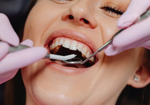 Unveiling The Impact Of Dental Services On Preventive Health Care In Dripping Springs