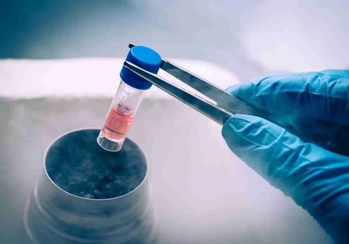 The Advantages Of IV Stem Cell Therapies In South Carolina For Your Preventive Healthcare