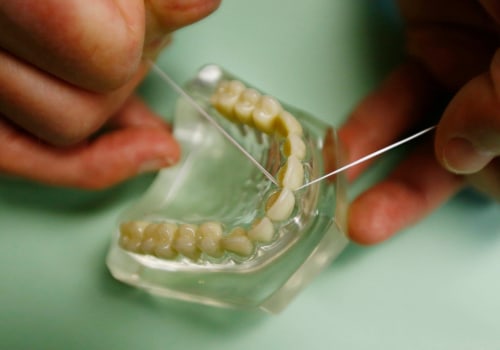 The Value of Preventive Oral Health Care In Colts Neck, NJ